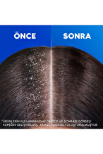 Head And Shoulders Şampuan Derinlemesine Nemlendirici 1+1 330 ml