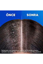 Head And Shoulders Şampuan Klasik Bakım 1+1 330 ml