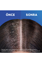 Head and Shoulders Mentol Ferahlığı Şampuan 800 ml