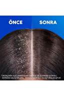 Head And Shoulders Şampuan Saç Dökülmesi Karşıtı 330 ml