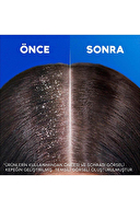 Head And Shoulders Şampuan Saç Dökülmesi Karşıtı Kadın 1+1 330 ml