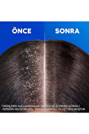 Head And Shoulders Şampuan Mentol Ferahlığı 2+1 330 ml